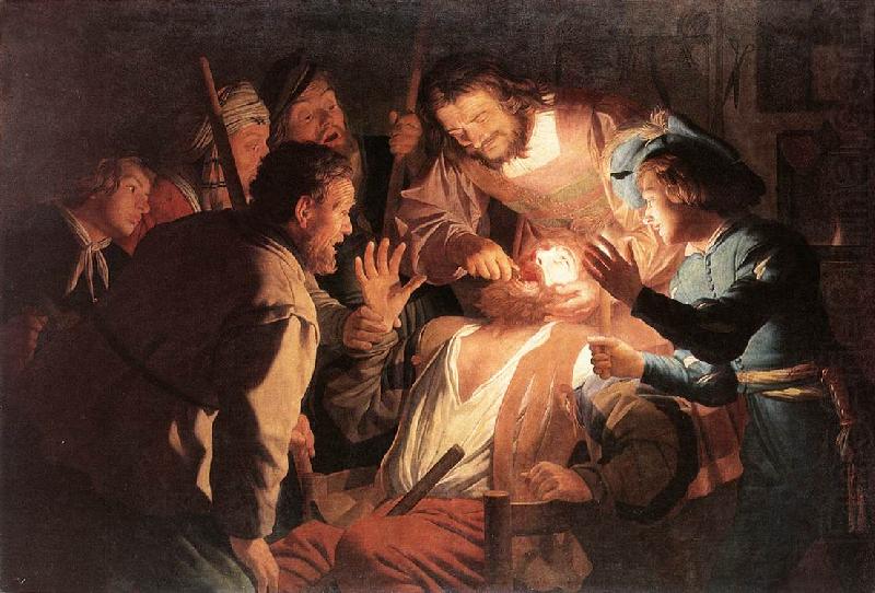 The Dentist sg, HONTHORST, Gerrit van